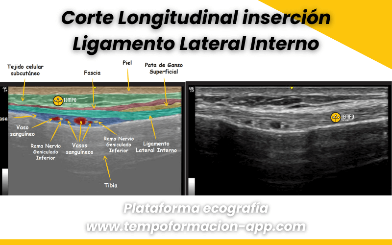 2. Ecografia tempo formacion rodilla.png